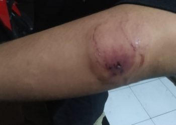 Penyidik Polres Nganjuk Diduga Mengulur Waktu Dalam Perkara Laporan Pengeroyokan