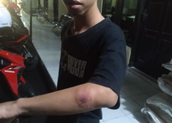 Korban Penganiayaan di Terminal Nganjuk Resmi Lapor Polisi