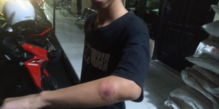 Korban Penganiayaan di Terminal Nganjuk Resmi Lapor Polisi