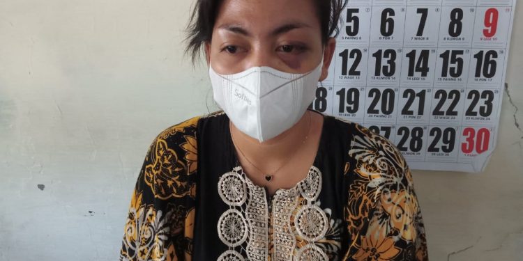 Ingat Janda Cantik Yang Menghilang ? Kini Telah Kembali Dengan Luka Lebam