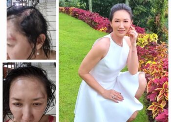 Bangkit dari Trauma, Sherly Chebing   Menjadi Suara bagi Korban Kekerasan