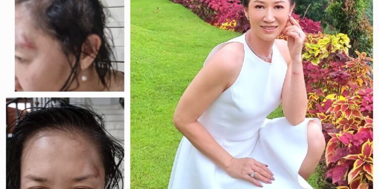 Bangkit dari Trauma, Sherly Chebing   Menjadi Suara bagi Korban Kekerasan