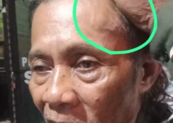 Relawan RBC Mojokerto Yang Alami Penganiayaan Akhirnya Lapor Polisi