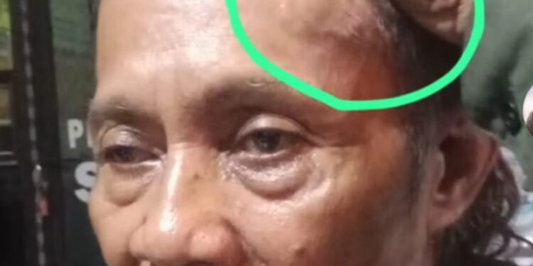 Relawan RBC Mojokerto Yang Alami Penganiayaan Akhirnya Lapor Polisi